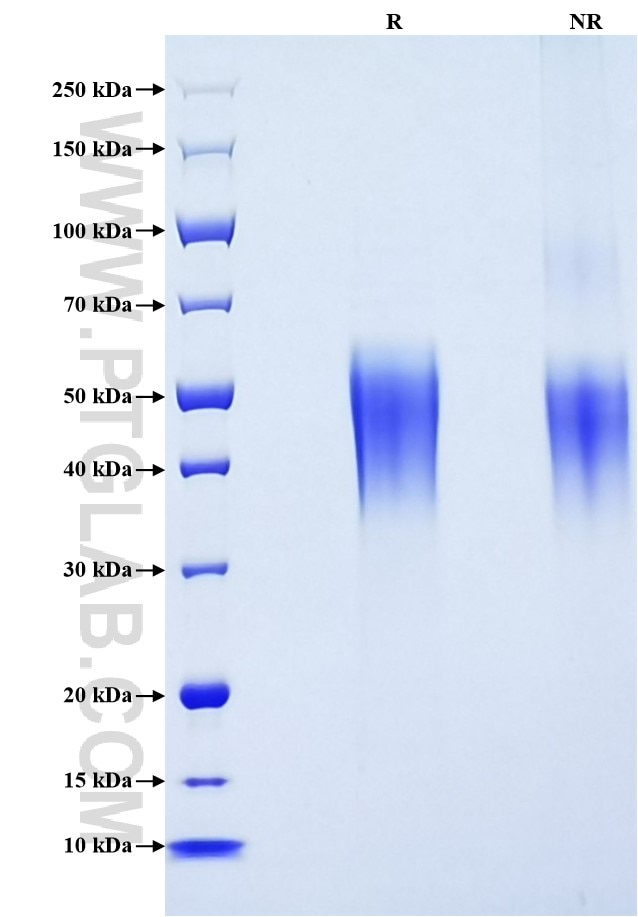 Purity of Recombinant Human FCGR3B was determined by SDS-PAGE. The protein was resolved in an SDS-PAGE in reducing (R) and non-reducing (NR) conditions and stained using Coomassie blue.