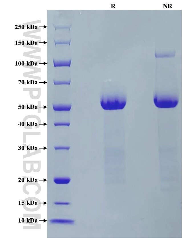 Purity of Recombinant Mouse Osteopontin was determined by SDS-PAGE. The protein was resolved in an SDS-PAGE in reducing (R) and non-reducing (NR) conditions and stained using Coomassie blue.