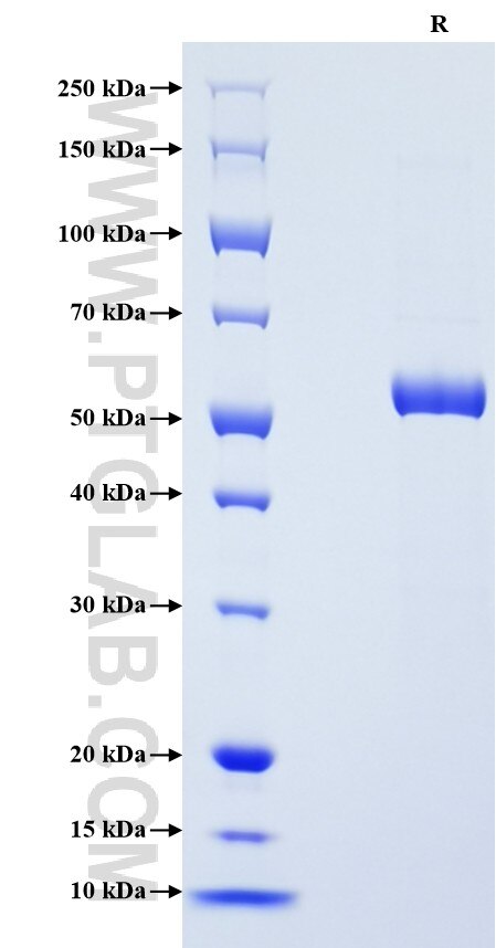 Purity of Recombinant Human ADIPOQ was determined by SDS-PAGE. The protein was resolved in an SDS-PAGE in reducing (R) condition and stained using Coomassie blue.