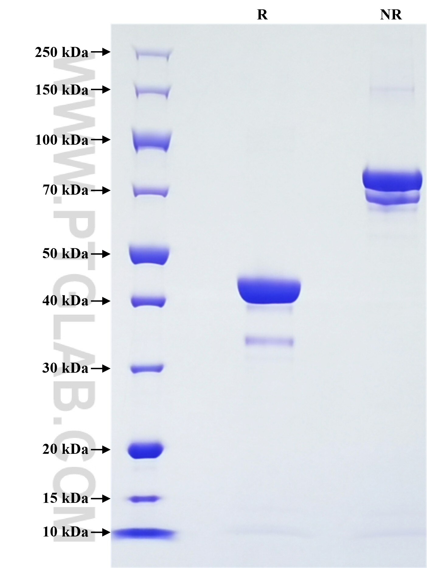Purity of Recombinant Human Leptin was determined by SDS-PAGE. The protein was resolved in an SDS-PAGE in reducing (R) and non-reducing (NR) conditions and stained using Coomassie blue.