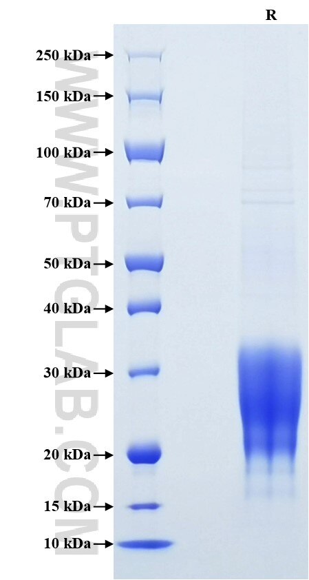 Purity of Recombinant Mouse IFN-gamma was determined by SDS-PAGE. The protein was resolved in an SDS-PAGE in reducing (R) conditions and stained using Coomassie blue.