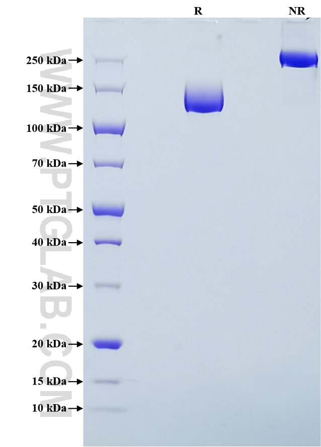 Purity of Recombinant Human VEGFR2 was determined by SDS-PAGE. The protein was resolved in an SDS-PAGE in reducing (R) and non-reducing (NR) conditions and stained using Coomassie blue.
