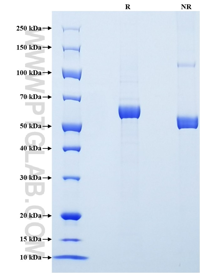 Purity of Recombinant Human MMP-3 was determined by SDS-PAGE. The protein was resolved in an SDS-PAGE in reducing (R) and non-reducing (NR) conditions and stained using Coomassie blue.