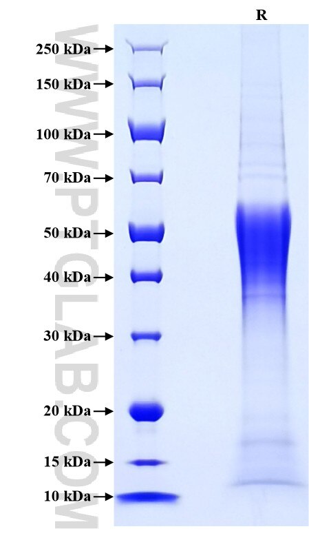 Purity of Recombinant Rat CCL2 was determined by SDS-PAGE. The protein was resolved in an SDS-PAGE in reducing (R) conditions and stained using Coomassie blue.