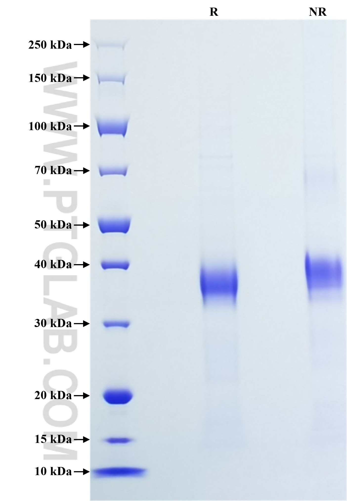 Purity of Recombinant Human SOST was determined by SDS-PAGE. The protein was resolved in an SDS-PAGE in reducing (R) and non-reducing (NR) conditions and stained using Coomassie blue. Purity of Recombinant Human SOST was determined by SDS-PAGE. The protein was resolved in an SDS-PAGE in reducing (R) and non-reducing (NR) conditions and stained using Coomassie blue.