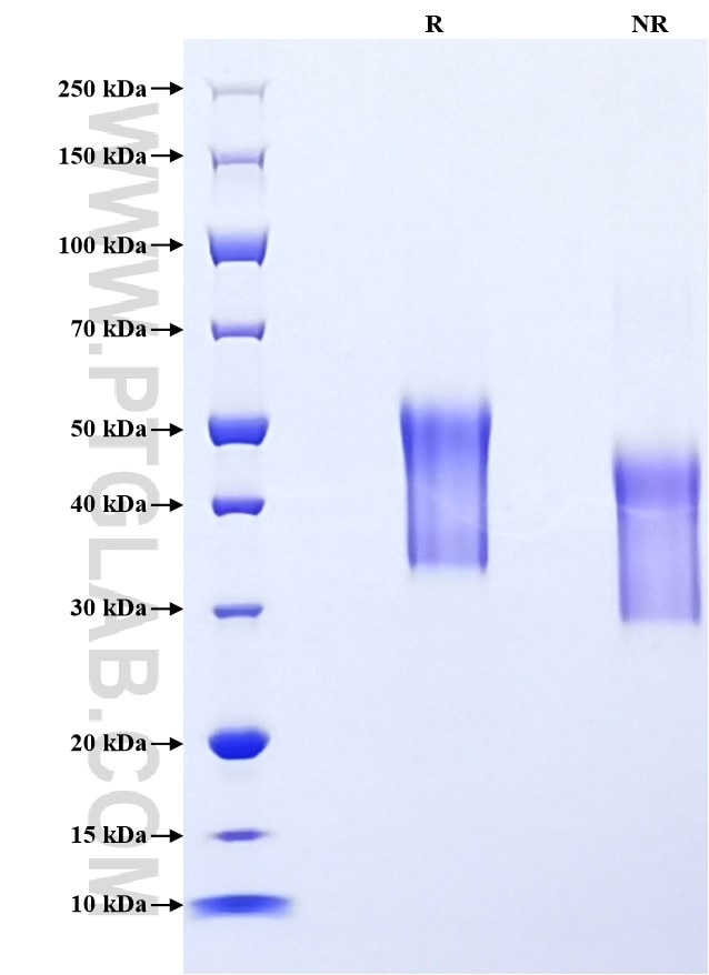 Purity of Recombinant Human CD25 was determined by SDS-PAGE. The protein was resolved in an SDS-PAGE in reducing (R) and non-reducing (NR) conditions and stained using Coomassie blue.