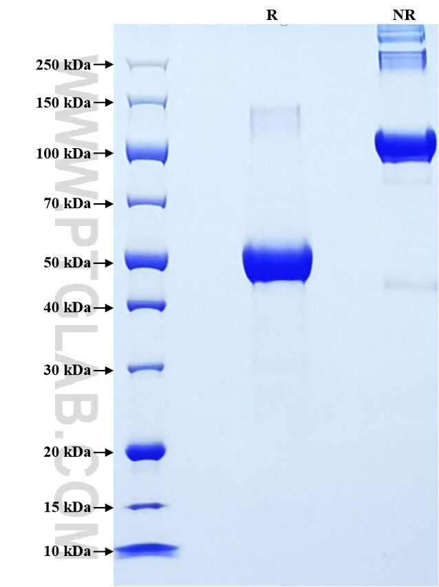 Purity of Recombinant Human TIMP2 was determined by SDS-PAGE. The protein was resolved in an SDS-PAGE in reducing (R) and non-reducing (NR) conditions and stained using Coomassie blue.