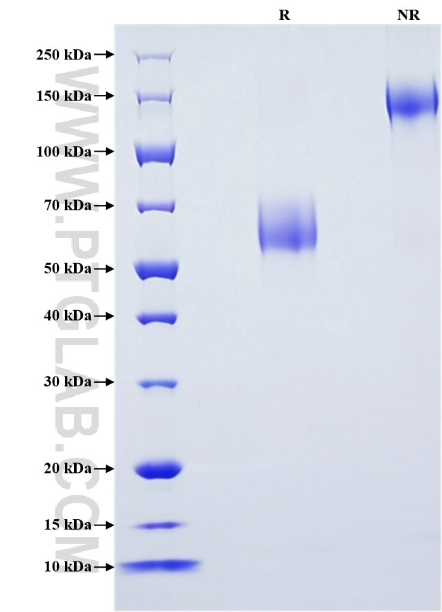 Purity of Recombinant Rat CCL2 was determined by SDS-PAGE. The protein was resolved in an SDS-PAGE in reducing (R) and non-reducing (NR) conditions and stained using Coomassie blue. Purity of Recombinant Rat CCL2 was determined by SDS-PAGE. The protein was resolved in an SDS-PAGE in reducing (R) and non-reducing (NR) conditions and stained using Coomassie blue.