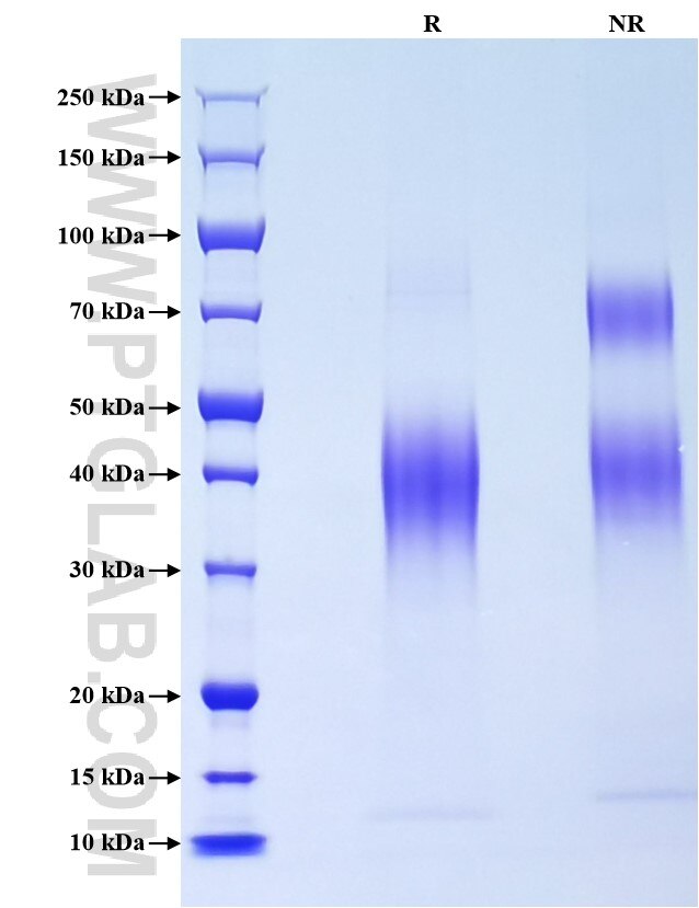 Purity of Recombinant Mouse MCP-1 was determined by SDS-PAGE. The protein was resolved in an SDS-PAGE in reducing (R) and non-reducing (NR) conditions and stained using Coomassie blue.