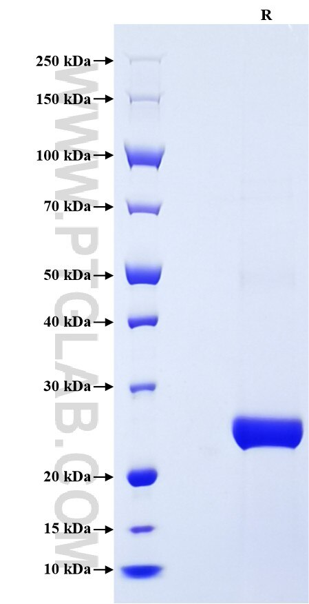 Purity of Recombinant Human TIMP2 was determined by SDS-PAGE. The protein was resolved in an SDS-PAGE in reducing (R) condition and stained using Coomassie blue.