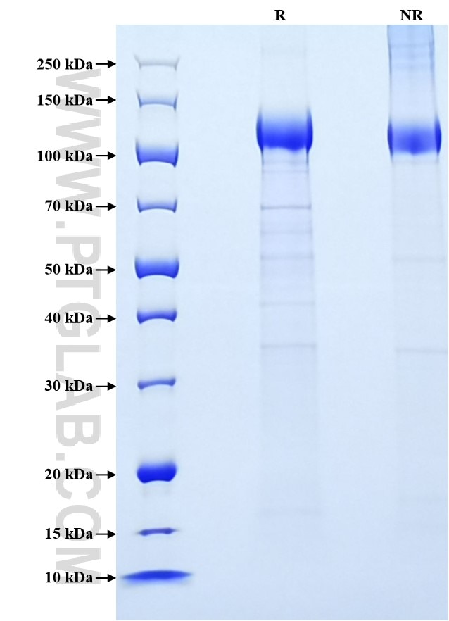 Purity of Recombinant Human VEGFR1 was determined by SDS-PAGE. The protein was resolved in an SDS-PAGE in reducing (R) and non-reducing (NR) conditions and stained using Coomassie blue.