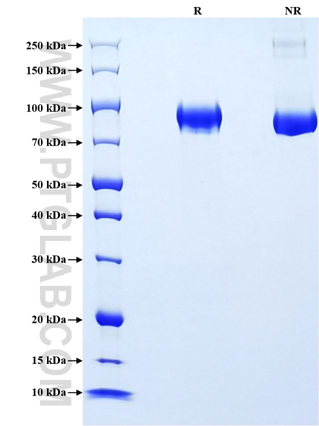 Purity of Recombinant Human MMP9 was determined by SDS-PAGE. The protein was resolved in an SDS-PAGE in reducing (R) and non-reducing (NR) conditions and stained using Coomassie blue.