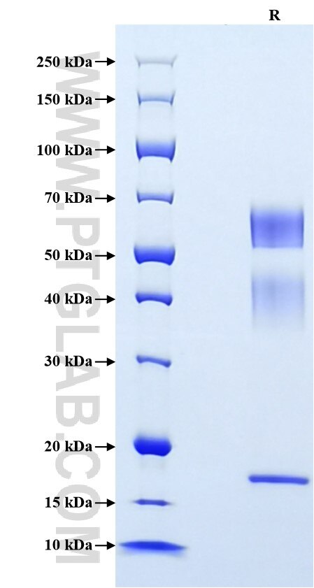 Purity of Recombinant Human Haptoglobin was determined by SDS-PAGE. The protein was resolved in an SDS-PAGE in reducing (R) conditions and stained using Coomassie blue.