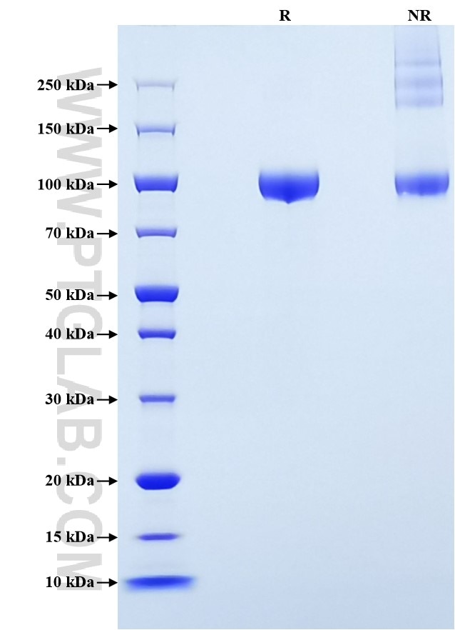 Purity of Recombinant Mouse MMP-9 was determined by SDS-PAGE. The protein was resolved in an SDS-PAGE in reducing (R) and non-reducing (NR) conditions and stained using Coomassie blue.
