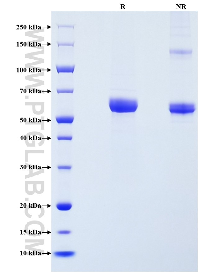 Purity of Recombinant Human MMP-1 was determined by SDS-PAGE. The protein was resolved in an SDS-PAGE in reducing (R) and non-reducing (NR) conditions and stained using Coomassie blue.