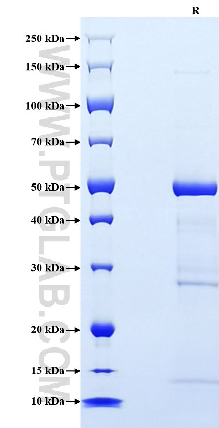Purity of Recombinant Mouse CRP Protein was determined by SDS-PAGE. The protein was resolved in an SDS-PAGE in reducing (R) conditions and stained using Coomassie blue. Purity of Recombinant Mouse CRP Protein was determined by SDS-PAGE. The protein was resolved in an SDS-PAGE in reducing (R) conditions and stained using Coomassie blue.