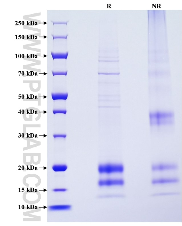 Purity of Recombinant Mouse MIF was determined by SDS-PAGE. The protein was resolved in an SDS-PAGE in reducing (R) and non-reducing (NR) conditions and stained using Coomassie blue.