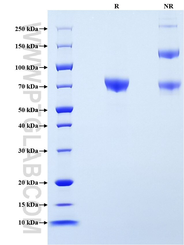 Purity of Recombinant Human Endoglin was determined by SDS-PAGE. The protein was resolved in an SDS-PAGE in reducing (R) and non-reducing (NR) conditions and stained using Coomassie blue.