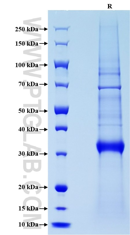 Purity of Recombinant Human GZMB was determined by SDS-PAGE. The protein was resolved in an SDS-PAGE in reducing (R) condition and stained using Coomassie blue.