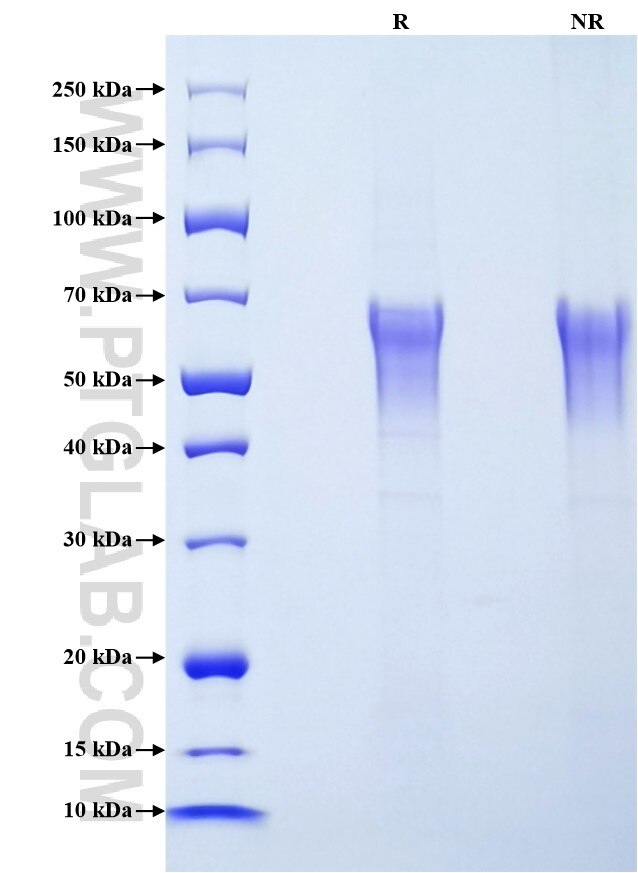 Purity of Recombinant Rat KIM-1 was determined by SDS-PAGE. The protein was resolved in an SDS-PAGE in reducing (R) and non-reducing (NR) conditions and stained using Coomassie blue.