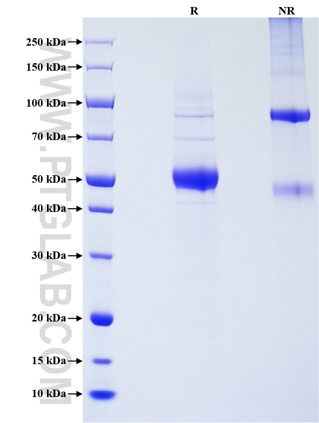Purity of Recombinant Mouse Osteoprotegerin was determined by SDS-PAGE. The protein was resolved in an SDS-PAGE in reducing (R) and non-reducing (NR) conditions and stained using Coomassie blue. Purity of Recombinant Mouse Osteoprotegerin was determined by SDS-PAGE. The protein was resolved in an SDS-PAGE in reducing (R) and non-reducing (NR) conditions and stained using Coomassie blue.