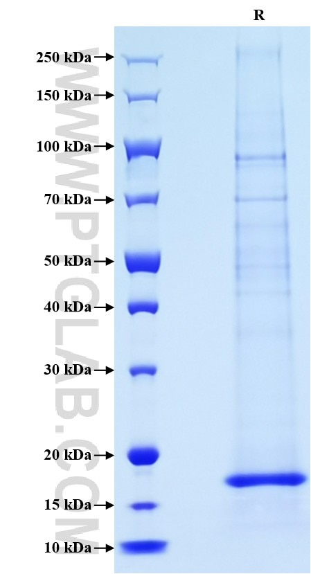 Purity of Recombinant Human IL21 was determined by SDS-PAGE. The protein was resolved in an SDS-PAGE in reducing (R) condition and stained using Coomassie blue.