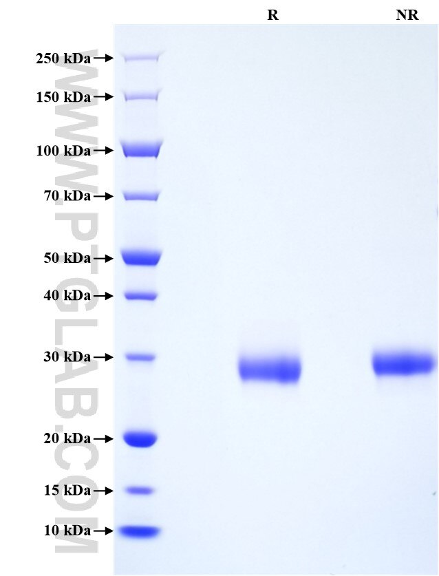 Purity of Recombinant Human TIMP-1 was determined by SDS-PAGE. The protein was resolved in an SDS-PAGE in reducing (R) and non-reducing (NR) conditions and stained using Coomassie blue.