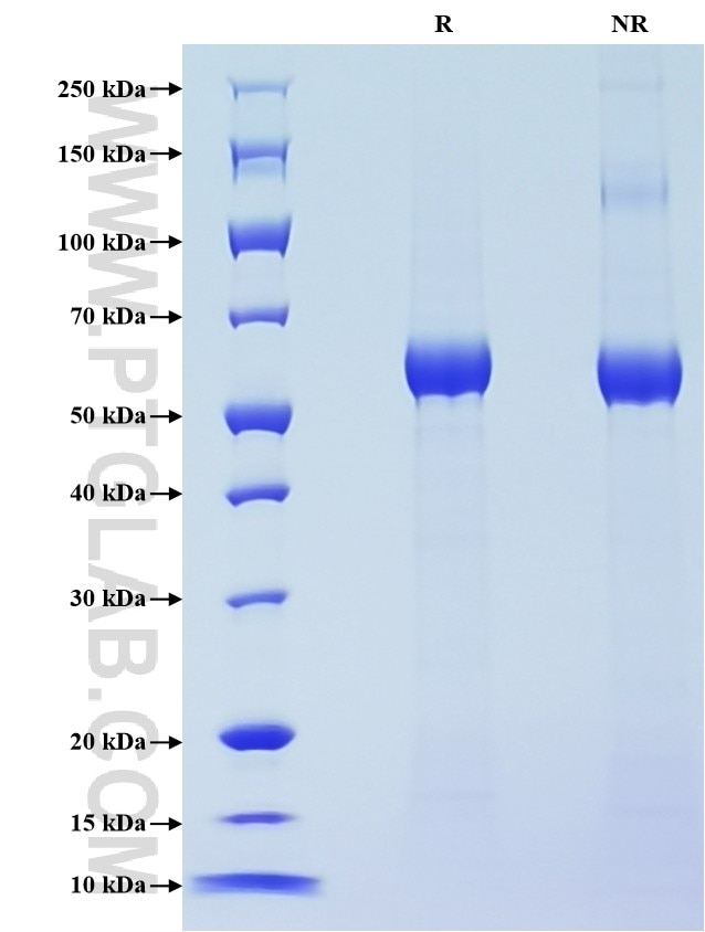 Purity of Recombinant Human LBP was determined by SDS-PAGE. The protein was resolved in an SDS-PAGE in reducing (R) and non-reducing (NR) conditions and stained using Coomassie blue.