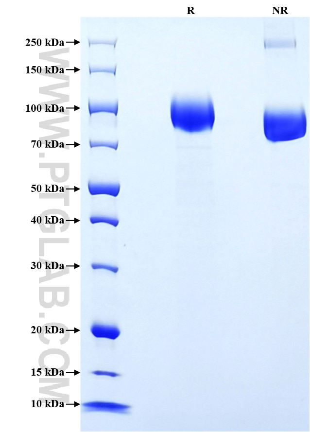 Purity of Recombinant Mouse NCAM-1 was determined by SDS-PAGE. The protein was resolved in an SDS-PAGE in reducing (R) and non-reducing (NR) conditions and stained using Coomassie blue.
