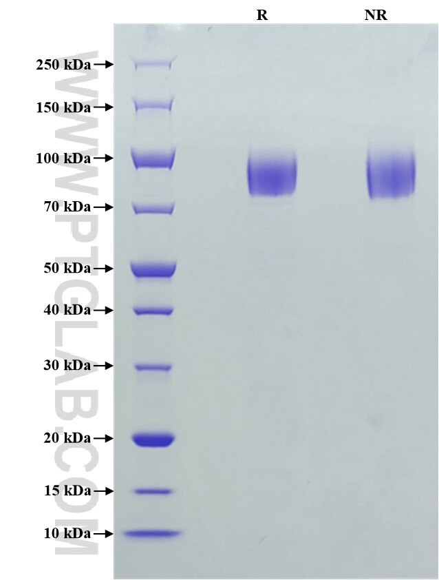 Purity of Recombinant Human gp130 was determined by SDS-PAGE. The protein was resolved in an SDS-PAGE in reducing (R) and non-reducing (NR) conditions and stained using Coomassie blue.