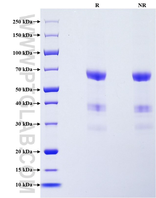 Purity of Recombinant Human ANGPTL3 was determined by SDS-PAGE. The protein was resolved in an SDS-PAGE in reducing (R) and non-reducing (NR) conditions and stained using Coomassie blue.