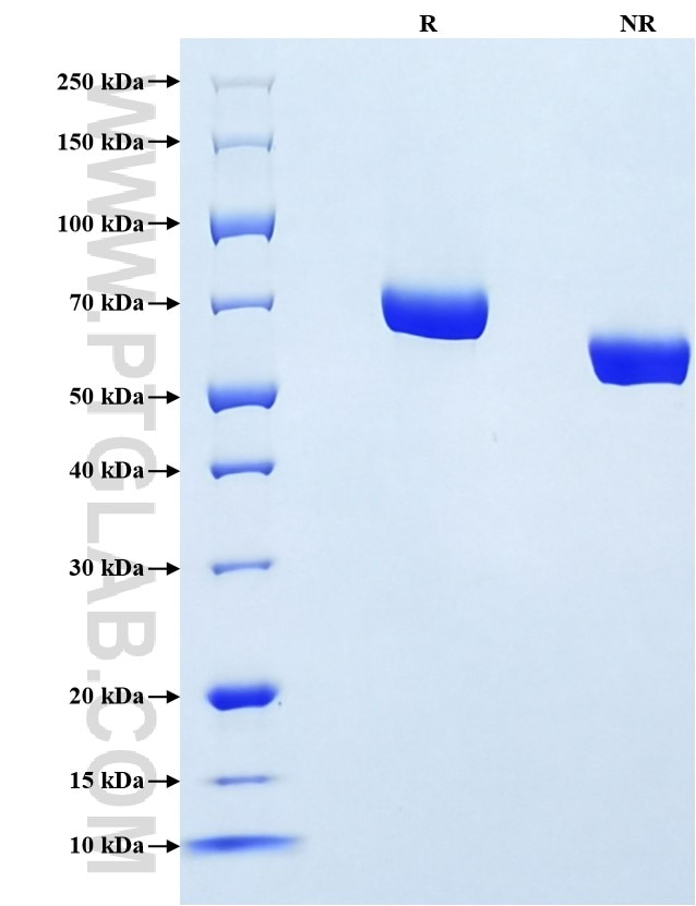 Purity of Recombinant Mouse AFP was determined by SDS-PAGE. The protein was resolved in an SDS-PAGE in reducing (R) and non-reducing (NR) conditions and stained using Coomassie blue.