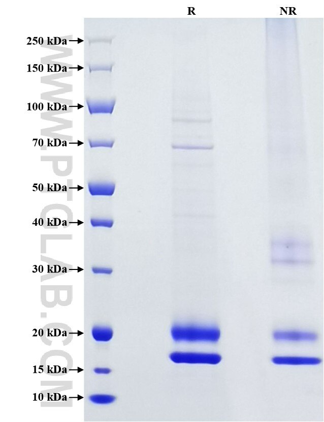 Purity of Recombinant Mouse IL-1RA was determined by SDS-PAGE. The protein was resolved in an SDS-PAGE in reducing (R) and non-reducing (NR) conditions and stained using Coomassie blue.