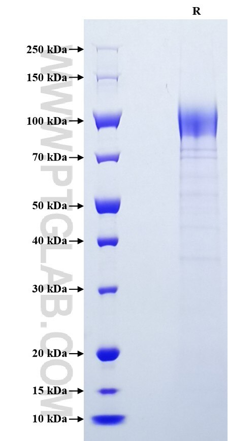 Purity of Recombinant Mouse Selp/P-selectin was determined by SDS-PAGE. The protein was resolved in an SDS-PAGE in reducing (R) condition and stained using Coomassie blue.
