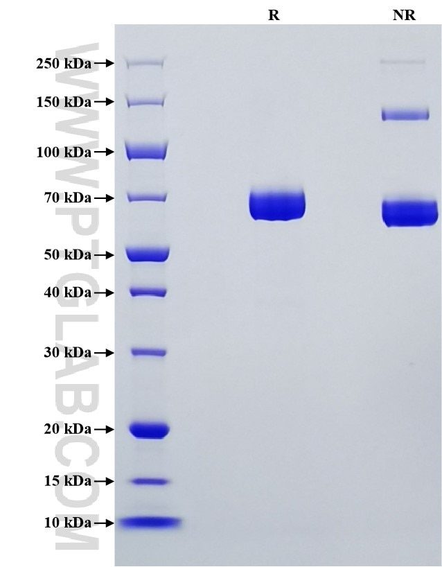 Purity of Recombinant Mouse IL-12 was determined by SDS-PAGE. The protein was resolved in an SDS-PAGE in reducing (R) and non-reducing (NR) conditions and stained using Coomassie blue.