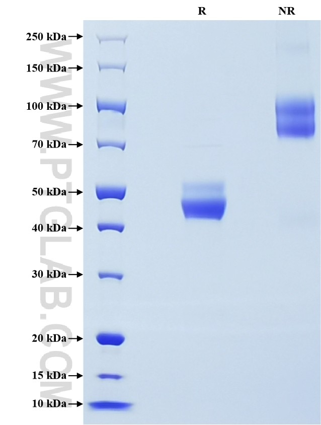 Purity of Recombinant Human TIGIT was determined by SDS-PAGE. The protein was resolved in an SDS-PAGE in reducing (R) and non-reducing (NR) conditions and stained using Coomassie blue. Purity of Recombinant Human TIGIT was determined by SDS-PAGE. The protein was resolved in an SDS-PAGE in reducing (R) and non-reducing (NR) conditions and stained using Coomassie blue.