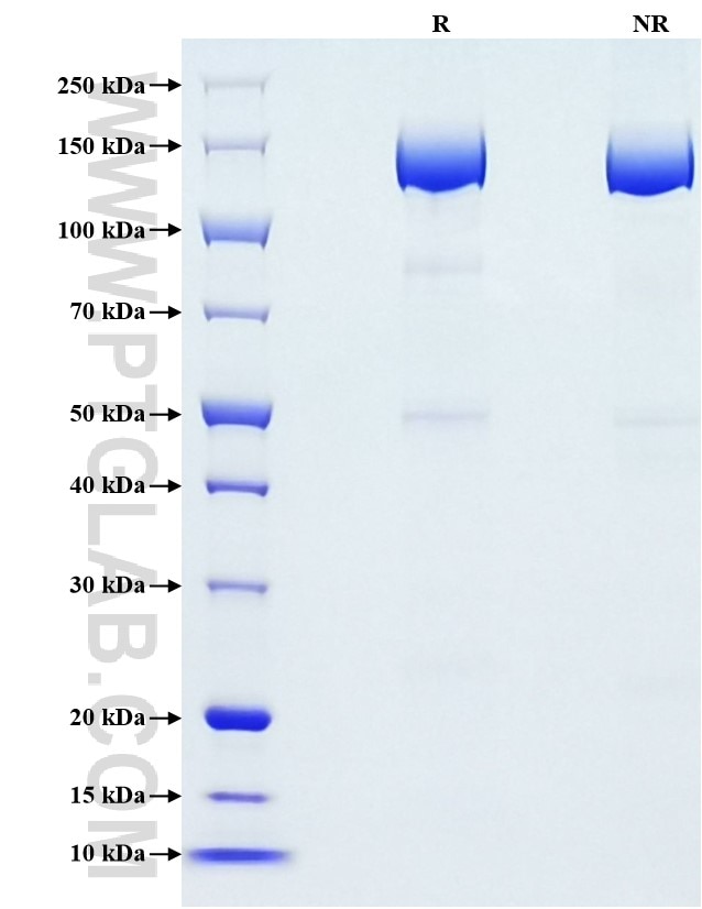 Purity of Recombinant Mouse MMR was determined by SDS-PAGE. The protein was resolved in an SDS-PAGE in reducing (R) and non-reducing (NR) conditions and stained using Coomassie blue.