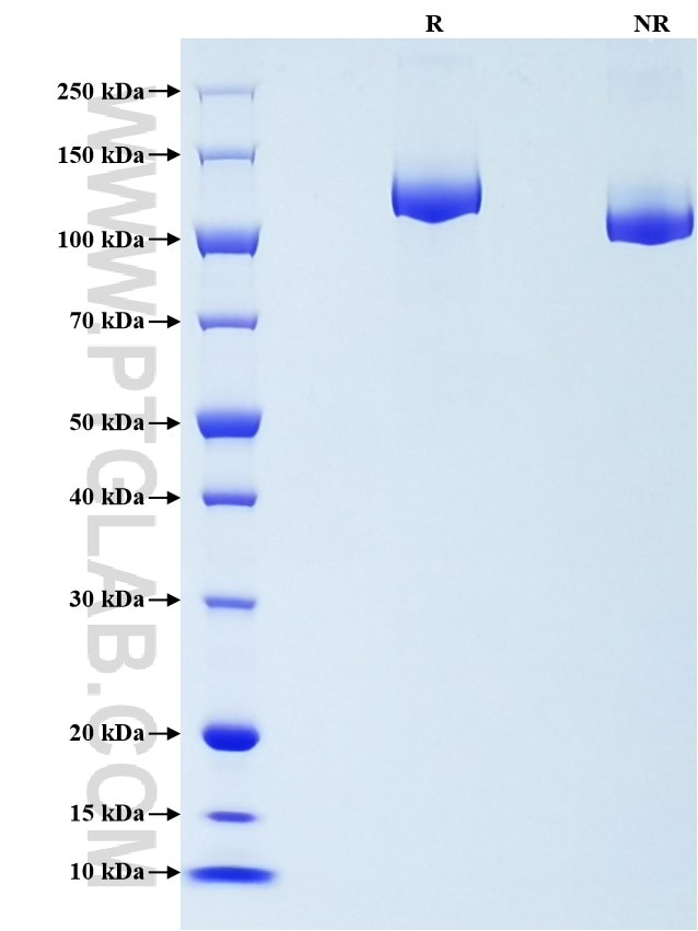 Purity of Recombinant Mouse CD163 was determined by SDS-PAGE. The protein was resolved in an SDS-PAGE in reducing (R) and non-reducing (NR) conditions and stained using Coomassie blue.