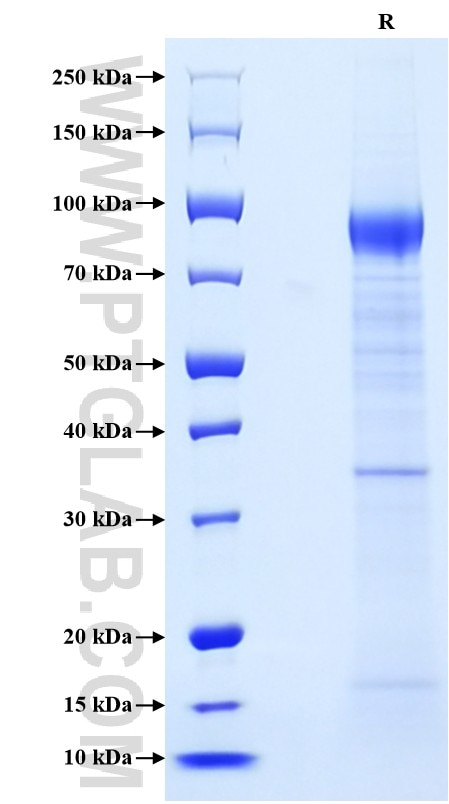 Purity of Recombinant Mouse Her2/ErbB2 was determined by SDS-PAGE. The protein was resolved in an SDS-PAGE in reducing (R) condition and stained using Coomassie blue.