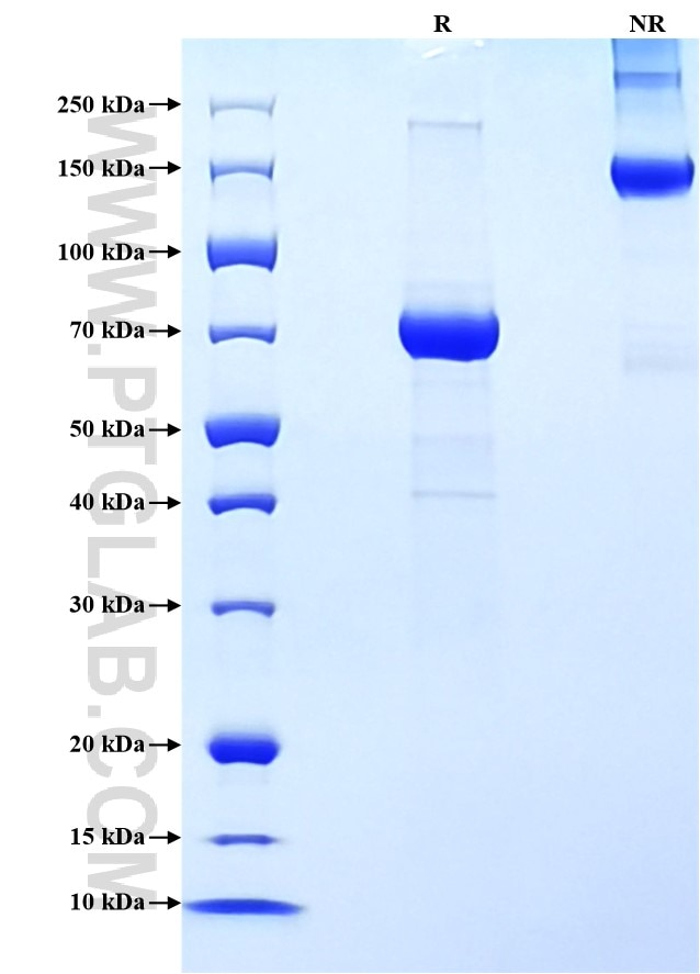 Purity of Recombinant Mouse IL-5RA was determined by SDS-PAGE. The protein was resolved in an SDS-PAGE in reducing (R) and non-reducing (NR) conditions and stained using Coomassie blue.