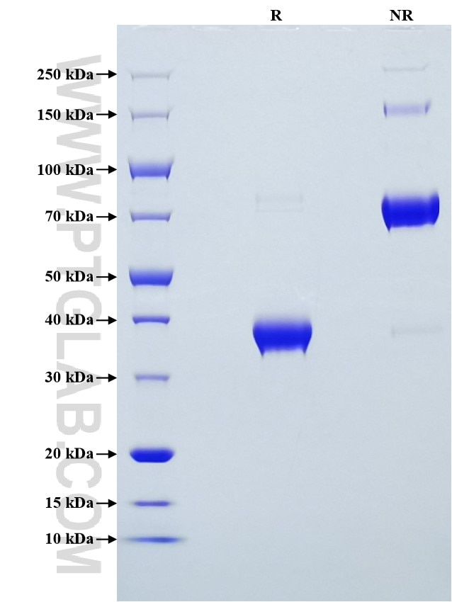 Purity of Recombinant Human BCMA was determined by SDS-PAGE. The protein was resolved in an SDS-PAGE in reducing (R) and non-reducing (NR) conditions and stained using Coomassie blue.