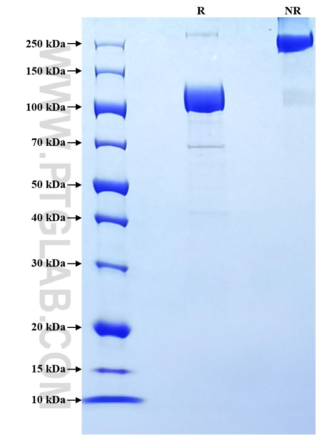 Purity of Recombinant Rat gp130 was determined by SDS-PAGE. The protein was resolved in an SDS-PAGE in reducing (R) and non-reducing (NR) conditions and stained using Coomassie blue. Purity of Recombinant Rat gp130 was determined by SDS-PAGE. The protein was resolved in an SDS-PAGE in reducing (R) and non-reducing (NR) conditions and stained using Coomassie blue.