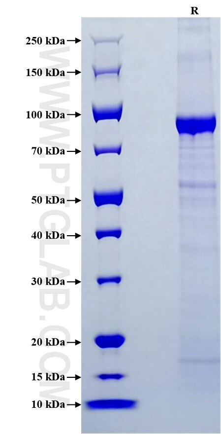Purity of Recombinant Mouse CD31/PECAM-1 was determined by SDS-PAGE. The protein was resolved in an SDS-PAGE in reducing (R) conditions and stained using Coomassie blue.