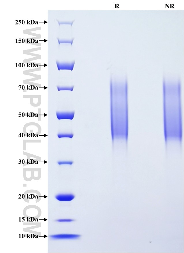 Purity of Recombinant Mouse CD34 was determined by SDS-PAGE. The protein was resolved in an SDS-PAGE in reducing (R) and non-reducing (NR) conditions and stained using Coomassie blue.