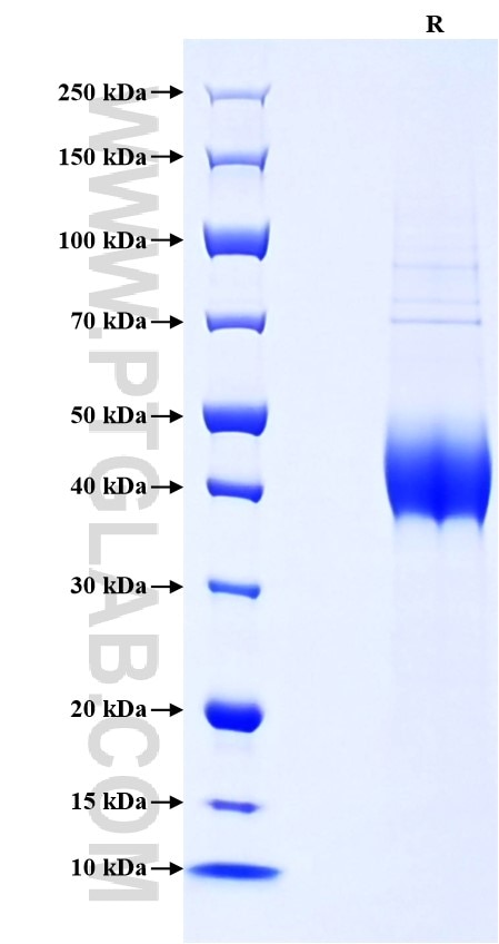 Purity of Recombinant Human TFPI was determined by SDS-PAGE. The protein was resolved in an SDS-PAGE in reducing (R) conditions and stained using Coomassie blue.