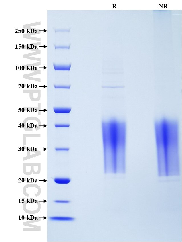 Purity of Recombinant Mouse TREM-1 was determined by SDS-PAGE. The protein was resolved in an SDS-PAGE in reducing (R) and non-reducing (NR) conditions and stained using Coomassie blue.