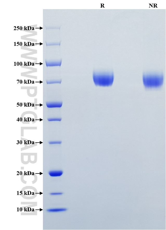 Purity of Recombinant Mouse CD117 was determined by SDS-PAGE. The protein was resolved in an SDS-PAGE in reducing (R) and non-reducing (NR) conditions and stained using Coomassie blue.