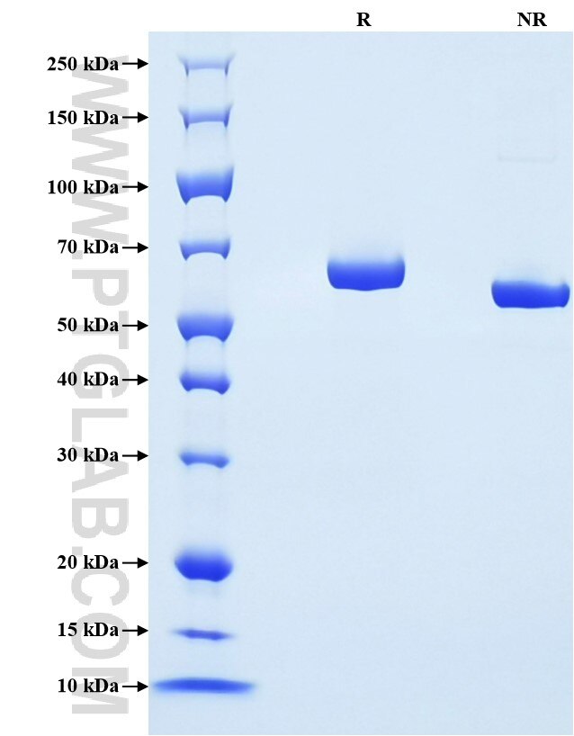 Purity of Recombinant Mouse Albumin was determined by SDS-PAGE. The protein was resolved in an SDS-PAGE in reducing (R) and non-reducing (NR) conditions and stained using Coomassie blue.