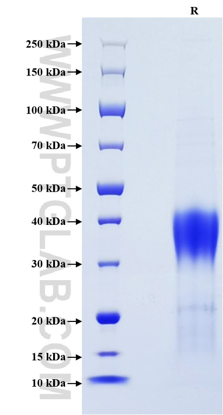 Purity of Recombinant Human CD28 was determined by SDS-PAGE. The protein was resolved in an SDS-PAGE in reducing (R) conditions and stained using Coomassie blue.
