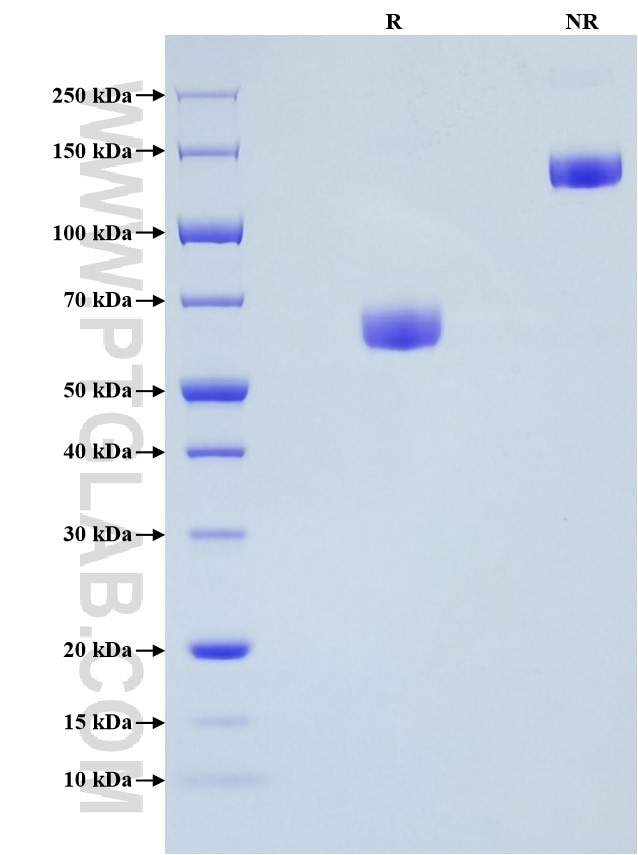 Purity of Recombinant Mouse CD200 was determined by SDS-PAGE. The protein was resolved in an SDS-PAGE in reducing (R) and non-reducing (NR) conditions and stained using Coomassie blue. Purity of Recombinant Mouse CD200 was determined by SDS-PAGE. The protein was resolved in an SDS-PAGE in reducing (R) and non-reducing (NR) conditions and stained using Coomassie blue.